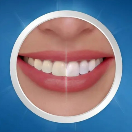 Crest 3D Whitestrips Professional Effects – Zahnaufhellung