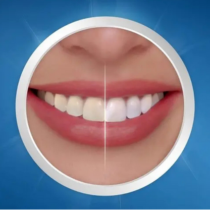 Crest 3D Whitestrips Professional Effects – Zahnaufhellung
